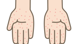 医療　高齢者　訪問看護　訪問診療　ホームアレー　在宅医療　かかりつけ医　看護師　看取り　手足口病　病気　季節の流行り病